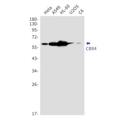 Western Blot: CBX4 Antibody (S08-4I3) [NBP3-19845]