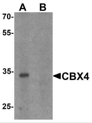 Western Blot: CBX4 AntibodyBSA Free [NBP2-81972]