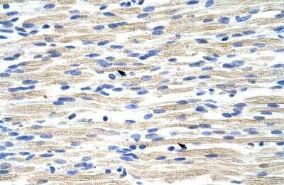 Immunohistochemistry: CBX6 Antibody [NBP2-87134]