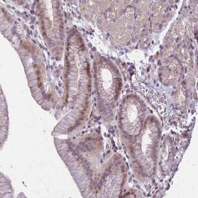 Immunohistochemistry-Paraffin: CBX6 Antibody [NBP2-14441]
