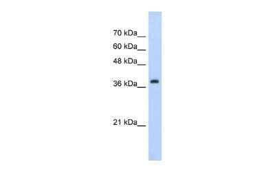 Western Blot: CBX6 Antibody [NBP2-87135]