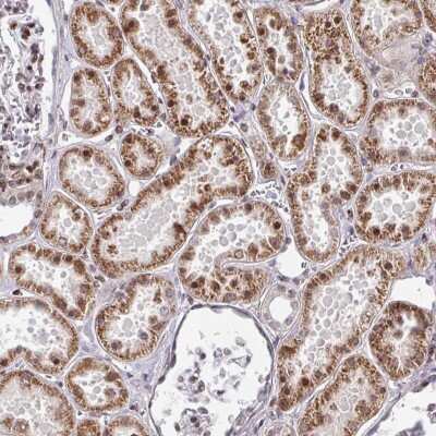 Immunohistochemistry: CBX7 Antibody [NBP2-38585]