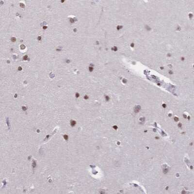 Immunohistochemistry-Paraffin: CBX7 Antibody [NBP2-38793]