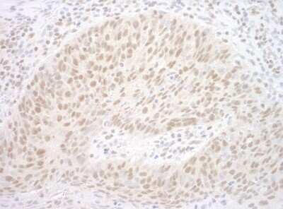 Immunohistochemistry-Paraffin: CBX7 Antibody [NBP1-40343]