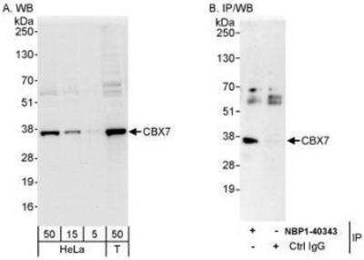 Western Blot: CBX7 Antibody [NBP1-40343]