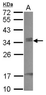 Western Blot: CBX7 Antibody [NBP2-15737]