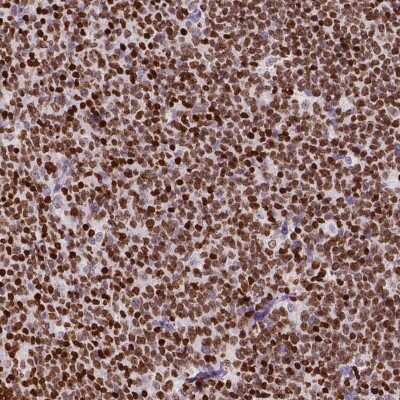 Immunohistochemistry-Paraffin: CBY3 Antibody [NBP2-49578]