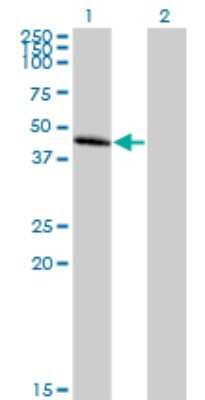 Western Blot: CC Chemokine Receptor D6 Antibody [H00001238-B01P]