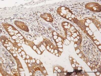 Immunohistochemistry-Paraffin: CC2D1A Antibody [H00054862-B01P]