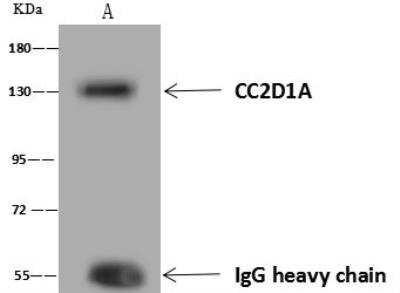 Immunoprecipitation: CC2D1A Antibody [NBP3-12658]