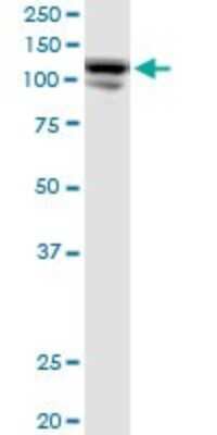 Western Blot: CC2D1A Antibody [H00054862-B01P]