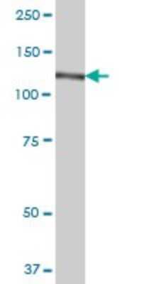 Western Blot: CC2D1A Antibody [H00054862-B01P]