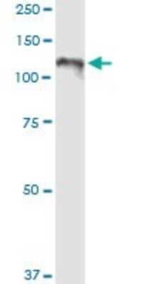 Western Blot: CC2D1A Antibody [H00054862-D01P]