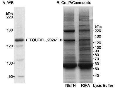 Western Blot: CC2D1A Antibody [NB500-255]