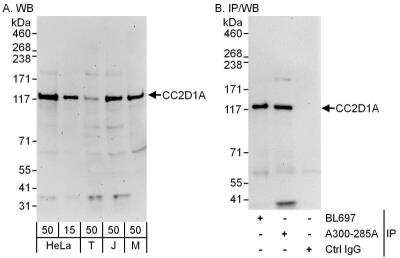 Western Blot: CC2D1A Antibody [NB500-255]
