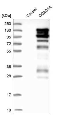 Western Blot: CC2D1A Antibody [NBP1-83666]