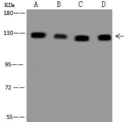 Western Blot: CC2D1A Antibody [NBP3-12658]