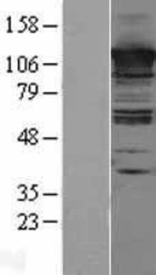 Western Blot: CC2D1A Overexpression Lysate [NBL1-08754]