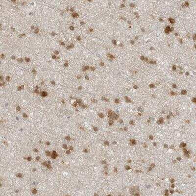 Immunohistochemistry-Paraffin: CC2D1B Antibody [NBP1-81369]