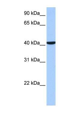 Western Blot: CC2D1B Antibody [NBP1-52841]