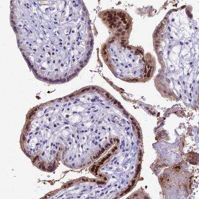 Immunohistochemistry-Paraffin: CC2D2A Antibody [NBP1-93673]