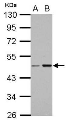 Western Blot: CC2D2B Antibody [NBP2-15738]