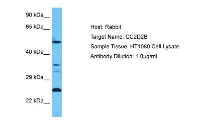 Western Blot: CC2D2B Antibody [NBP2-87136]