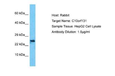 Western Blot: CC2D2B Antibody [NBP2-87137]