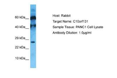 Western Blot: CC2D2B Antibody [NBP2-87138]