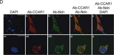 Immunocytochemistry/ Immunofluorescence: CCAR1 Antibody [NB500-186]