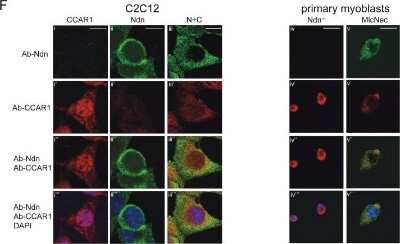 Immunocytochemistry/ Immunofluorescence: CCAR1 Antibody [NB500-186]