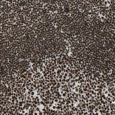 Immunohistochemistry-Paraffin: CCAR1 Antibody [NBP1-86626]