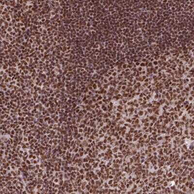 Immunohistochemistry-Paraffin: CCAR1 Antibody [NBP2-55611]