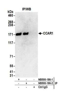Immunoprecipitation: CCAR1 Antibody [NB500-186]