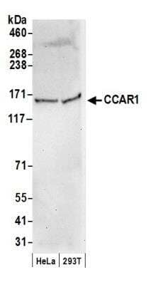 Western Blot: CCAR1 Antibody [NB100-258]