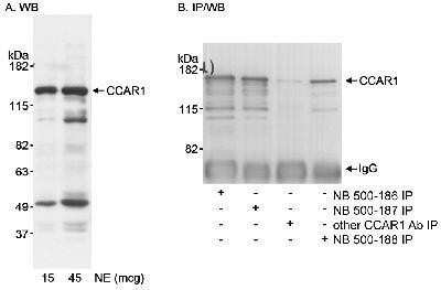 Western Blot: CCAR1 Antibody [NB500-186]