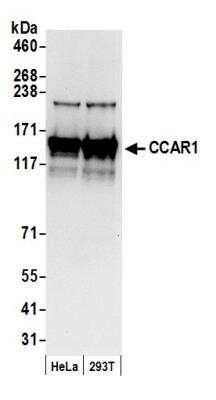 Western Blot: CCAR1 Antibody [NB500-188]