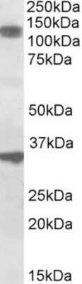 Western Blot: CCAR1 Antibody [NBP1-46158]