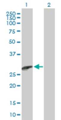 Western Blot: CCBE1 Antibody [H00147372-B01P]