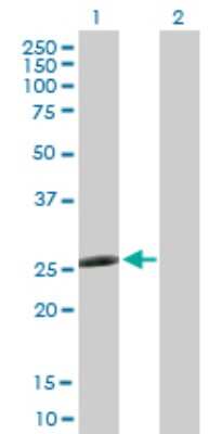 Western Blot: CCBE1 Antibody [H00147372-D01P]