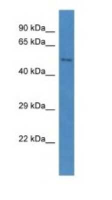 Western Blot: CCBE1 Antibody [NBP1-79501]