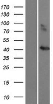 Western Blot: CCBE1 Overexpression Lysate [NBP2-05700]