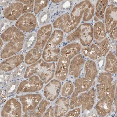 Immunohistochemistry-Paraffin: Cysteine Conjugate beta-Lyase/CCBL1 Antibody [NBP1-83315]