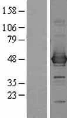 Western Blot: Cysteine Conjugate beta-Lyase/CCBL1 Overexpression Lysate [NBL1-08758]