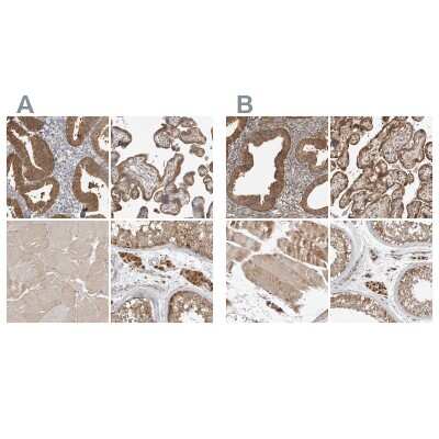 Immunohistochemistry-Paraffin: CCBL2 Antibody [NBP1-87387]