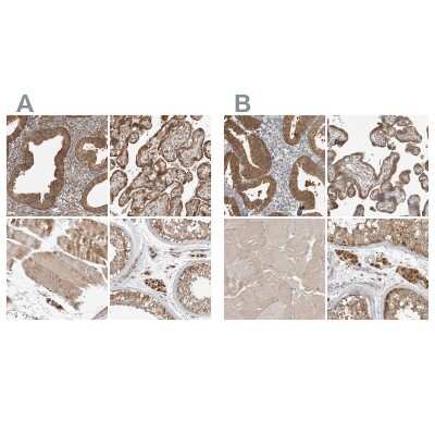 Immunohistochemistry-Paraffin: CCBL2 Antibody [NBP1-87388]