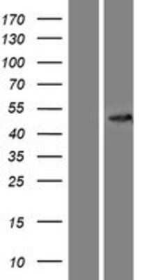 Western Blot: CCBL2 Overexpression Lysate [NBP2-11000]