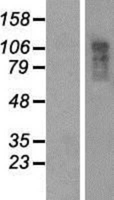 Western Blot: URB/CCD80 Overexpression Lysate [NBP2-04618]