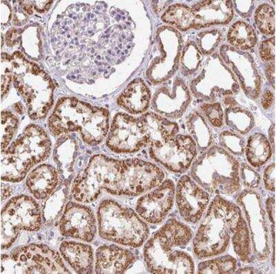 Immunohistochemistry: CCDC101 Antibody [NBP2-30685]