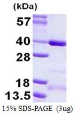 SDS-PAGE: Recombinant Human CCDC101 His Protein [NBP2-22786]